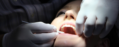Expert Teeth Cleaning Tips For You